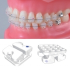 Bright-Ⅰ ceramic bracket (ROTH 018)